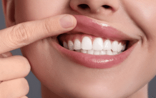 Healthy Gums Can Prevent a Heart Attack