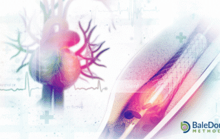 Heart Cath Vs Stent