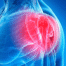 Is Left Shoulder Pain a Sign of a Heart Attack