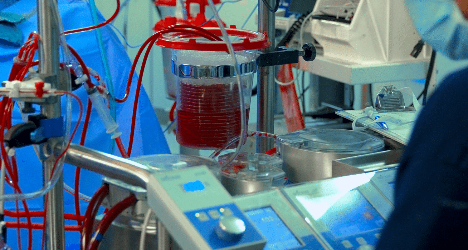 Cardiopulmonary Bypass Machine