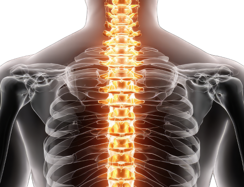 How to Prevent Spinal Stroke: Risk Factors, Lifestyle Changes, and Medical Management